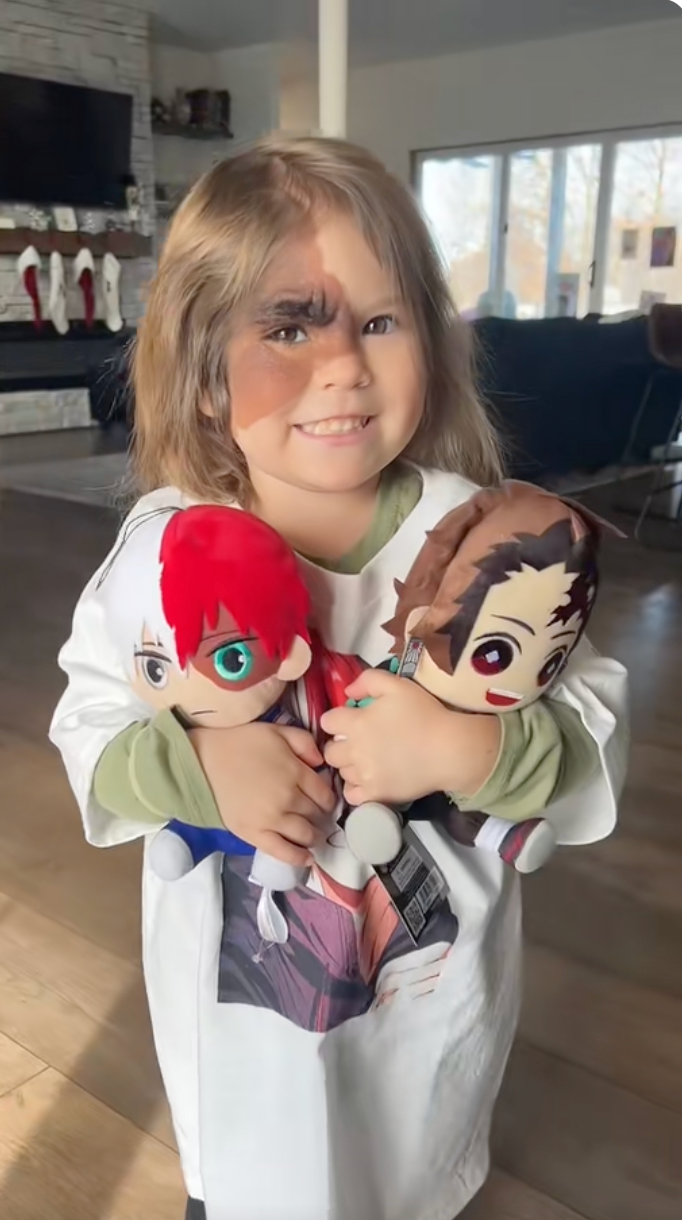 Winry with a large red birthmark on half her face